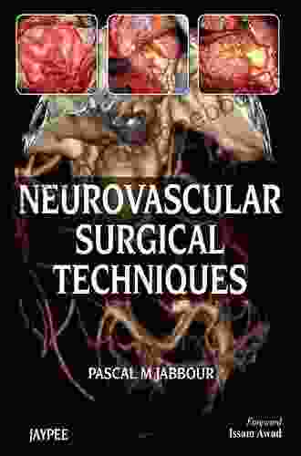 Neurovascular Surgical Techniques Alba Luz Morazan